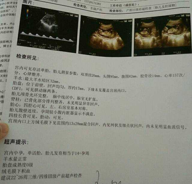 包成功太原代生,              想通过精子分离生个男孩，太原古交中心医院能做吗？            